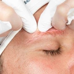 Dermalogica Dermalogica Pro Clear Skin Treatment 30 Minutes